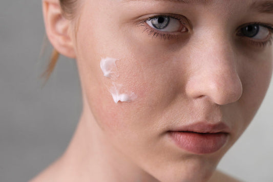 Dry Skin 101